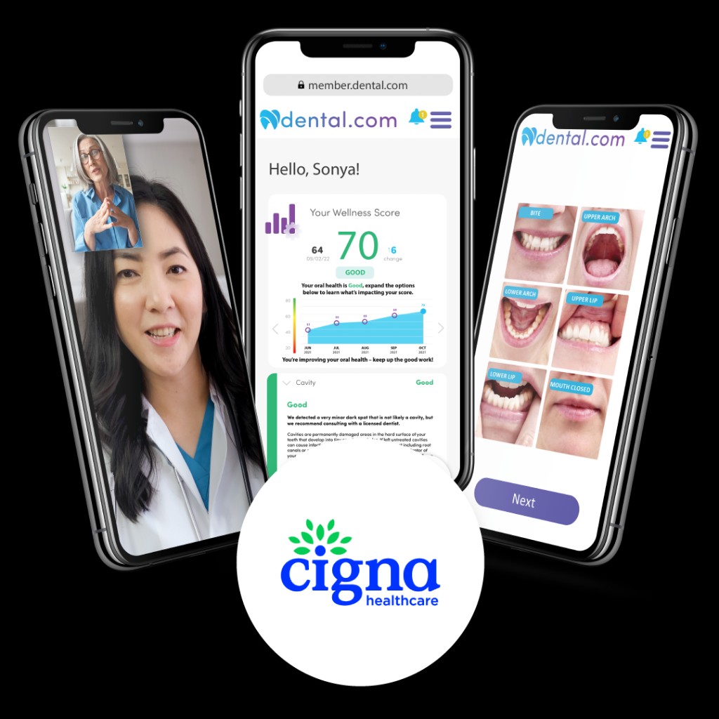 Cigna Healthcare SmartScan dental app showing wellness score and photo assessment screens